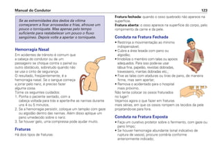 Hemorragia Nasal
Em acidentes de trânsito é comum que
a cabeça do condutor ou de um
passageiro se choque contra o painel ou
outro obstáculo, sobretudo quando não
se usa o cinto de segurança.
O resultado, freqüentemente, é a
hemorragia nasal. Se o sangue começa
a jorrar pelo nariz, é preciso fazer
alguma coisa.
Tome os seguintes cuidados:
1. Ponha o paciente sentado, com a
cabeça voltada para trás e aperte-lhe as narinas durante
uns 4 ou 5 minutos.
2. Se a hemorragia persistir, coloque um tampão com gaze
ou algodão dentro das narinas. Além disso aplique um
pano umedecido sobre o nariz.
3. Se houver gelo, uma compressa pode ajudar muito.
Fraturas
Há dois tipos de fraturas:
Se as extremidades dos dedos da vítima
começarem a ficar arroxeadas e frias, afrouxe um
pouco o torniquete. Mas apenas pelo tempo
suficiente para restabelecer um pouco o fluxo
sangüíneo. Depois volte a apertar o torniquete.
Fratura fechada: quando o osso quebrado não aparece na
superfície.
Fratura aberta: o osso aparece na superfície do corpo, pelo
rompimento da carne e da pele.
Conduta na Fratura Fechada
• Restrinja a movimentação ao mínimo
indispensável;
• Cubra a área lesada com pano ou
algodão;
• Imobilize o membro com talas ou apoios
adequados. Para isso pode-se usar
tábua fina, papelão, revistas dobradas,
travesseiro, mantas dobradas etc.;
• Fixe as talas com ataduras ou tiras de pano, de maneira
firme, mas sem apertar;
• Remova o acidentado para o hospital
mais próximo.
Não tente colocar os ossos fraturados
no lugar!
Vejamos agora o que fazer em fraturas
mais sérias, em que os ossos rompem os tecidos da pele
projetando-se para fora.
Conduta na Fratura Exposta
• Faça um curativo protetor sobre o ferimento, com gaze ou
pano limpo;
• Se houver hemorragia abundante (sinal indicativo de
ruptura de vasos), procure contê-la conforme
anteriormente indicado;
Manual do Condutor 123
 