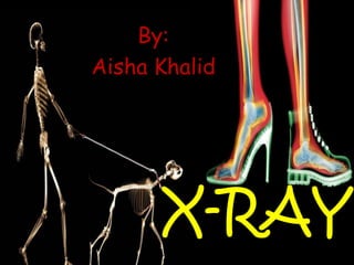 X-RAY
By:
Aisha Khalid
 