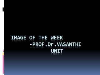 IMAGE OF THE WEEK
-PROF.Dr.VASANTHI
UNIT
 
