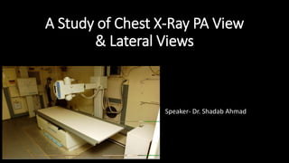 A Study of Chest X-Ray PA View
& Lateral Views
Speaker- Dr. Shadab Ahmad
 