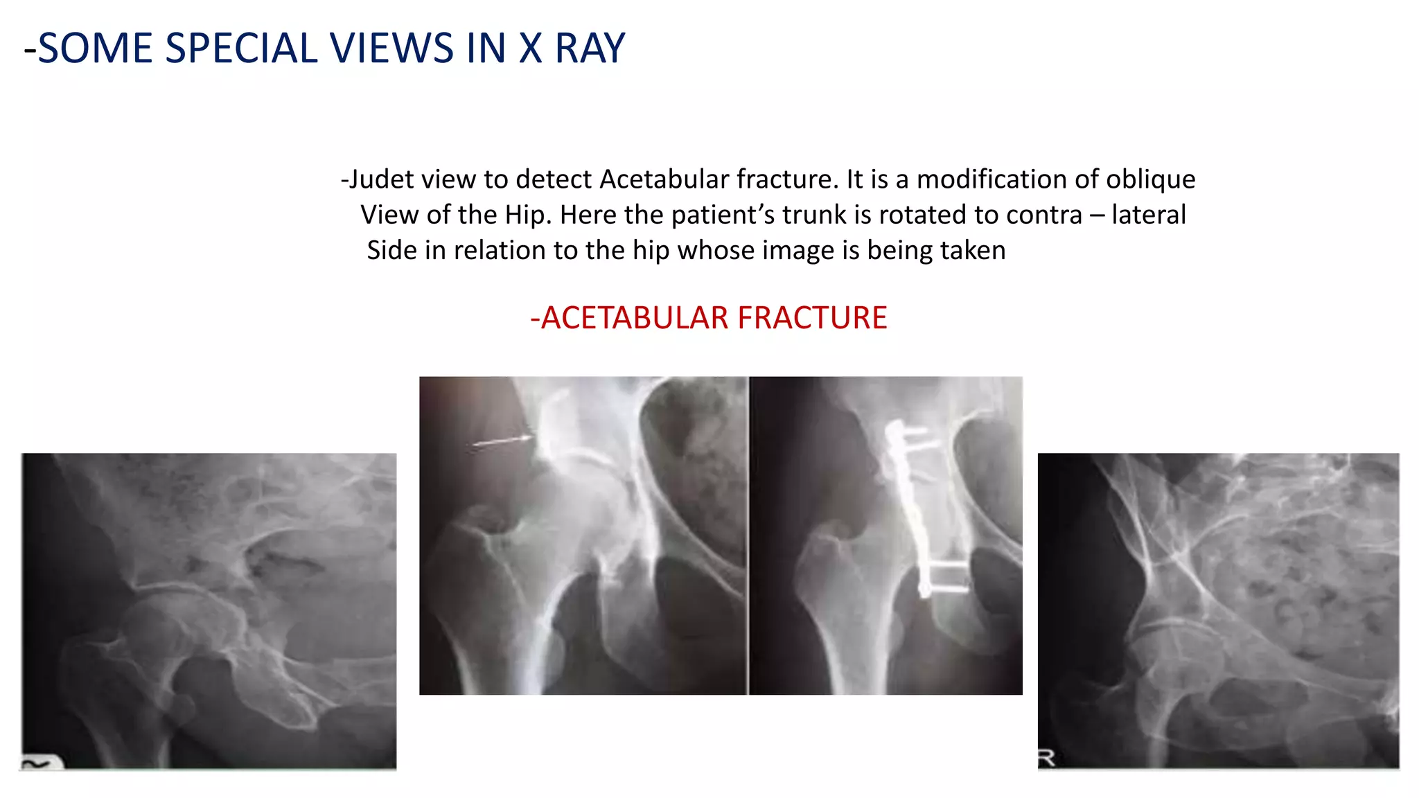 X ray | PPTX