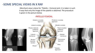 Normal Merchant Radiograph X ray | PPTX