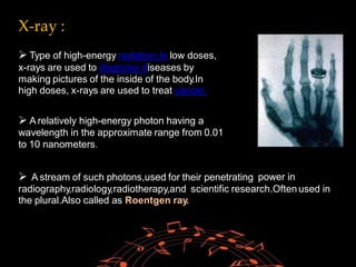 X-ray :
 Type of high-energy radiation.In low doses,
x-rays are used to diagnose diseases by
making pictures of the inside of the body.In
high doses, x-rays are used to treat cancer.
 A relatively high-energy photon having a
wavelength in the approximate range from 0.01
to 10 nanometers.
 A stream of such photons,used for their penetrating power in
radiography,radiology,radiotherapy,and scientific research.Often used in
the plural.Also called as Roentgen ray.
 