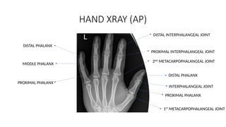 Middle Interphalang Slides of xray- detailed descriptions | PPTX