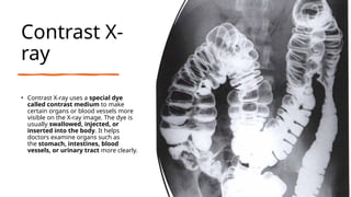 Comprehensive Overview of X-Ray Imaging: History, Techniques, and ...