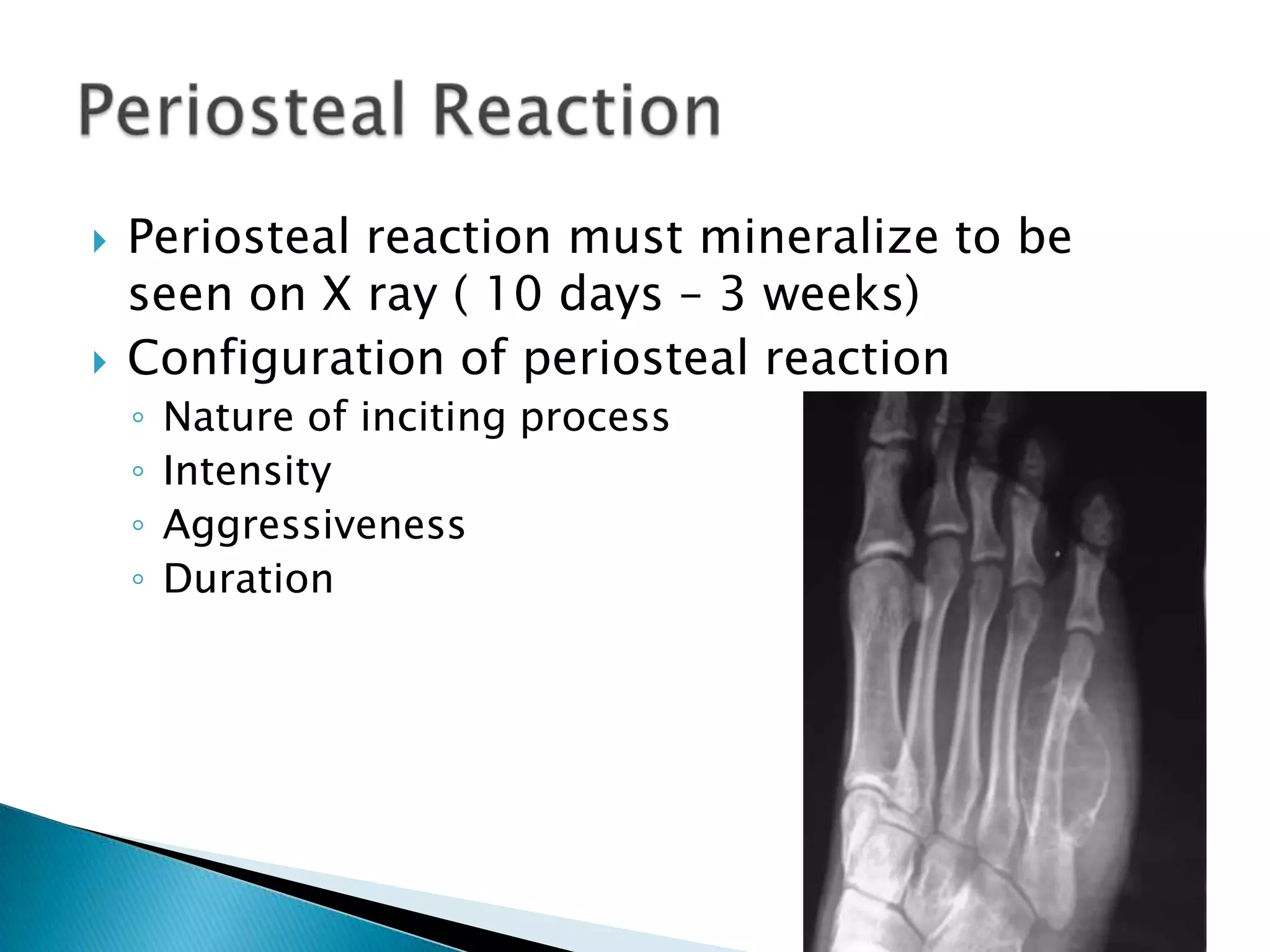    Periosteal reaction must mineralize to be
    seen on X ray ( 10 days – 3 weeks)
   Configuration of periosteal reaction
    ◦   Nature of inciting process
    ◦   Intensity
    ◦   Aggressiveness
    ◦   Duration
 