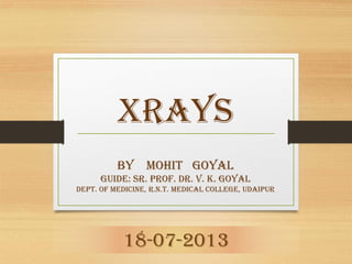 Xrays
By Mohit Goyal
Guide: Sr. Prof. Dr. V. K. Goyal
Dept. of Medicine, R.N.T. Medical College, Udaipur

18-07-2013

 