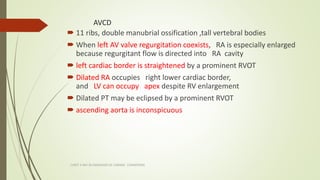 AVCD
 11 ribs, double manubrial ossification ,tall vertebral bodies
 When left AV valve regurgitation coexists, RA is es...