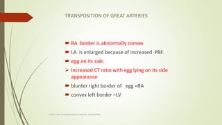 TRANSPOSITION OF GREAT ARTERIES
 RA border is abnormally convex
 LA is enlarged because of increased PBF.
 egg on its s...