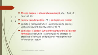  Thymic shadow is almost always absent after first 12
hours of life
 narrow vascular pedicle -PT is posterior and medial...
