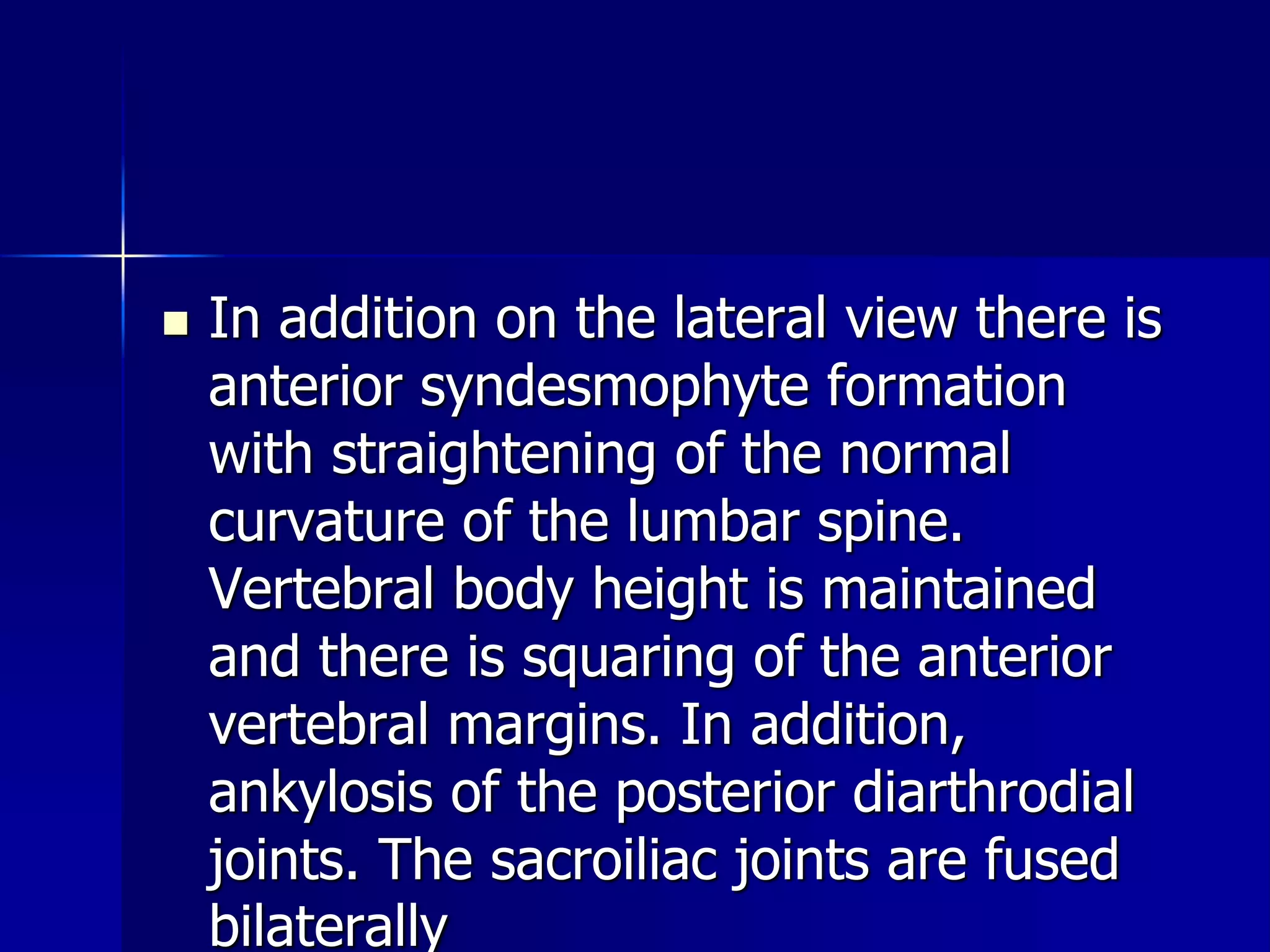  In addition on the lateral view there is 
anterior syndesmophyte formation 
with straightening of the normal 
curvature of the lumbar spine. 
Vertebral body height is maintained 
and there is squaring of the anterior 
vertebral margins. In addition, 
ankylosis of the posterior diarthrodial 
joints. The sacroiliac joints are fused 
bilaterally 
 