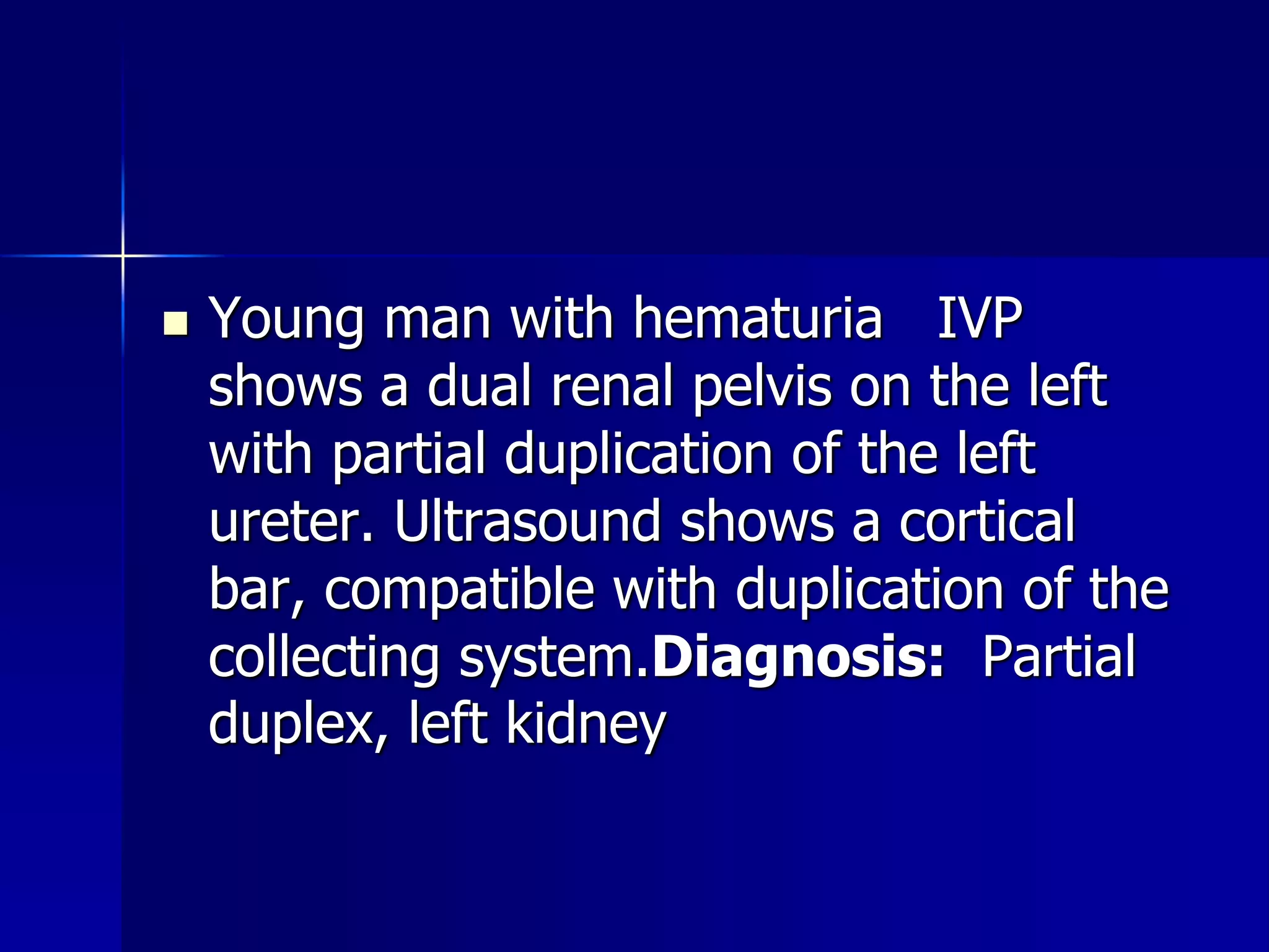  Young man with hematuria IVP 
shows a dual renal pelvis on the left 
with partial duplication of the left 
ureter. Ultrasound shows a cortical 
bar, compatible with duplication of the 
collecting system.Diagnosis: Partial 
duplex, left kidney 
 