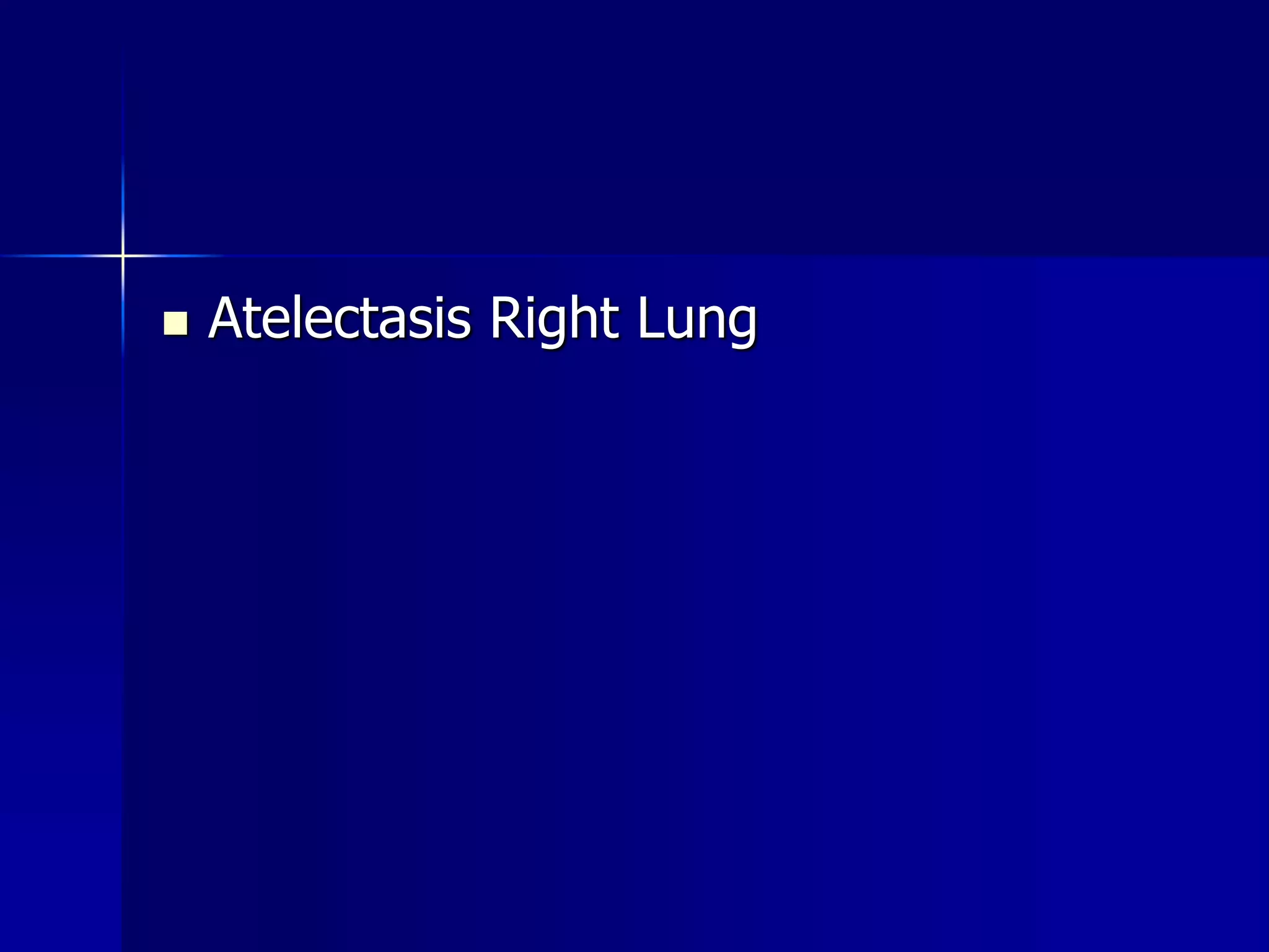  Atelectasis Right Lung 
 