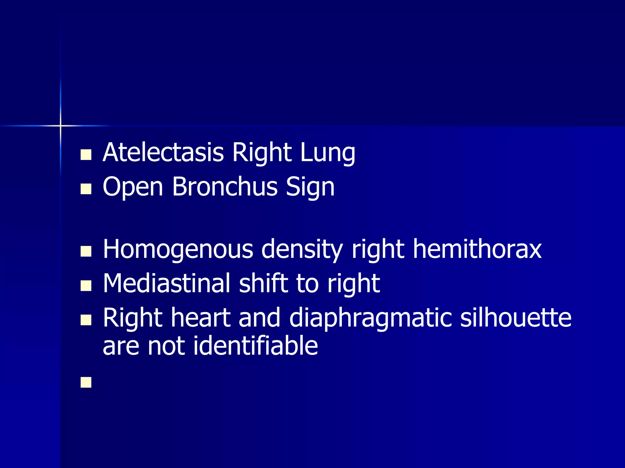  Atelectasis Right Lung 
 Open Bronchus Sign 
 Homogenous density right hemithorax 
 Mediastinal shift to right 
 Right heart and diaphragmatic silhouette 
are not identifiable 
 
 