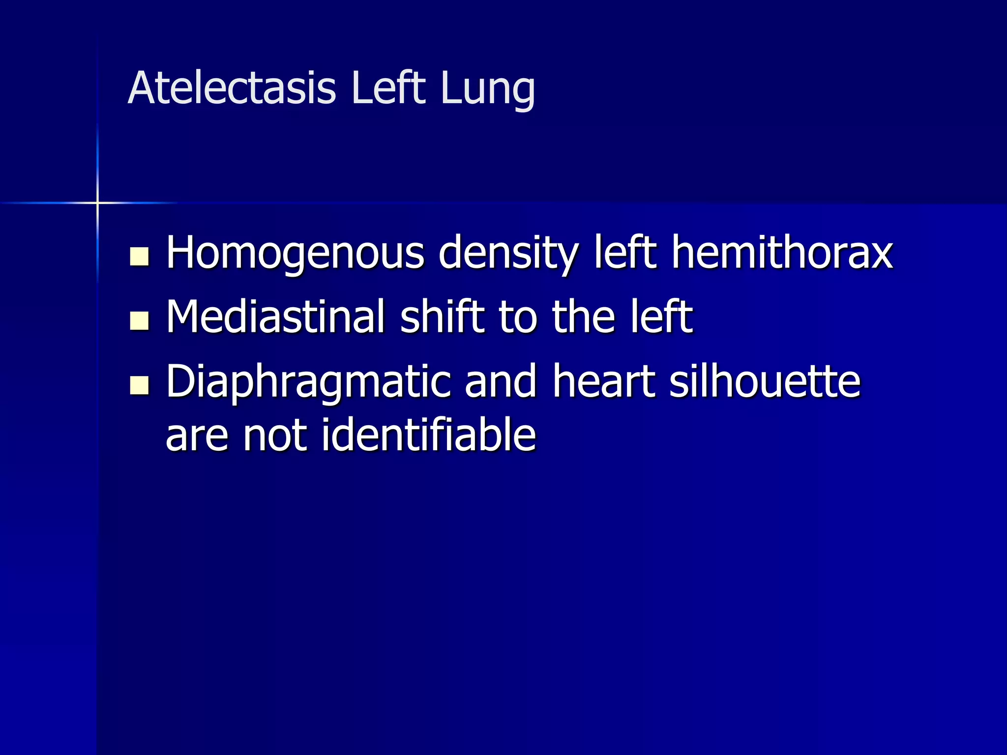 Atelectasis Left Lung 
 Homogenous density left hemithorax 
 Mediastinal shift to the left 
 Diaphragmatic and heart silhouette 
are not identifiable 
 