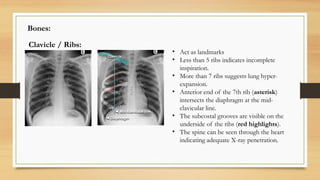 Xray and informed consent class by Dr Vaibhav | PPTX
