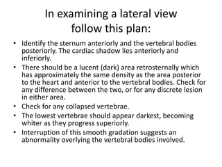 In examining a lateral view
follow this plan:
• Identify the sternum anteriorly and the vertebral bodies
posteriorly. The cardiac shadow lies anteriorly and
inferiorly.
• There should be a lucent (dark) area retrosternally which
has approximately the same density as the area posterior
to the heart and anterior to the vertebral bodies. Check for
any difference between the two, or for any discrete lesion
in either area.
• Check for any collapsed vertebrae.
• The lowest vertebrae should appear darkest, becoming
whiter as they progress superiorly.
• Interruption of this smooth gradation suggests an
abnormality overlying the vertebral bodies involved.
 