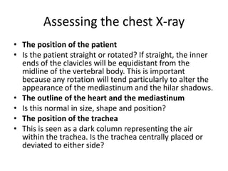 Assessing the chest X-ray
• The position of the patient
• Is the patient straight or rotated? If straight, the inner
ends of the clavicles will be equidistant from the
midline of the vertebral body. This is important
because any rotation will tend particularly to alter the
appearance of the mediastinum and the hilar shadows.
• The outline of the heart and the mediastinum
• Is this normal in size, shape and position?
• The position of the trachea
• This is seen as a dark column representing the air
within the trachea. Is the trachea centrally placed or
deviated to either side?
 