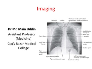 Imaging
Dr Md Main Uddin
Assistant Professor
(Medicine)
Cox’s Bazar Medical
College
 