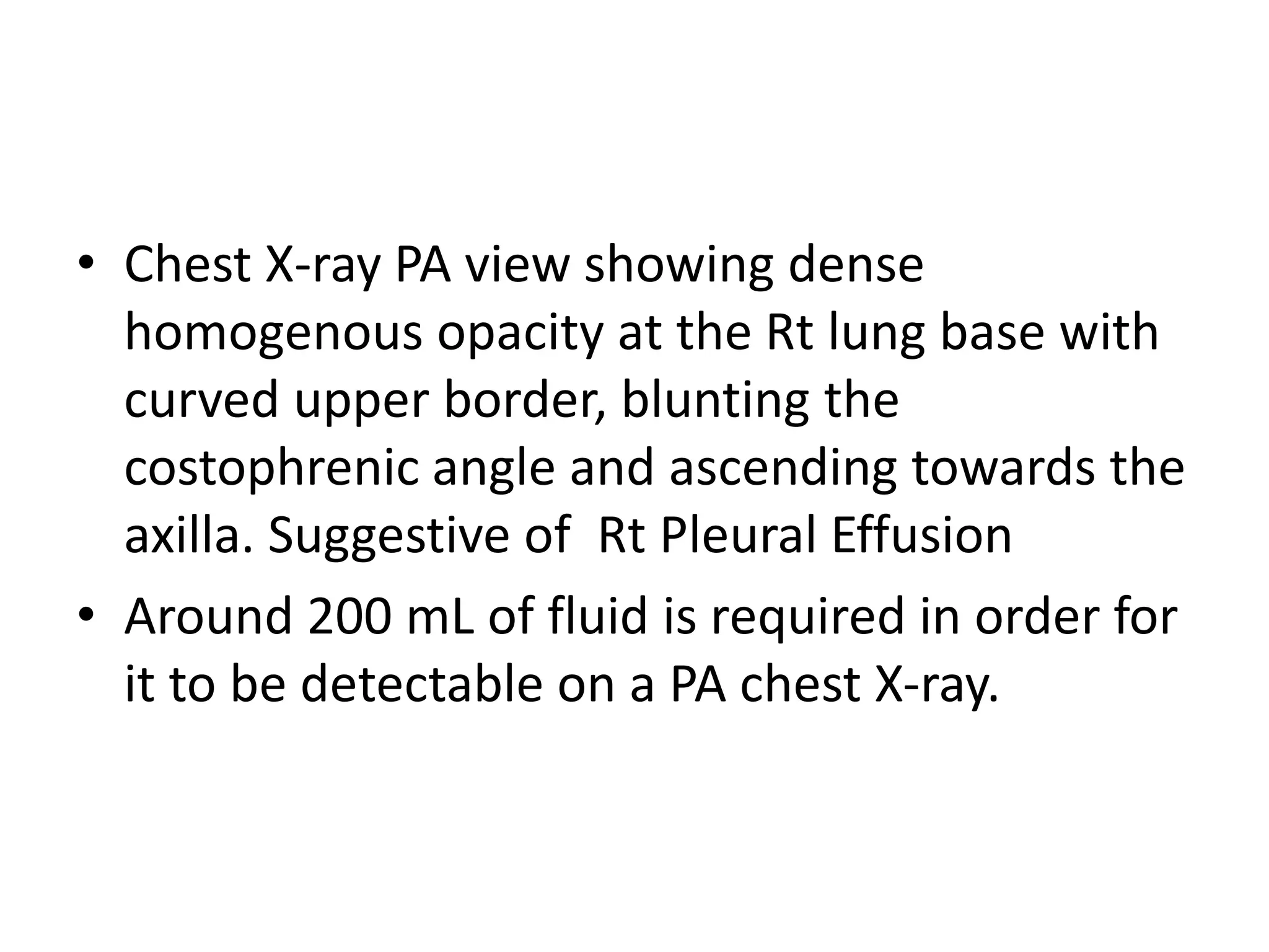 • Chest X-ray PA view showing dense
homogenous opacity at the Rt lung base with
curved upper border, blunting the
costophrenic angle and ascending towards the
axilla. Suggestive of Rt Pleural Effusion
• Around 200 mL of fluid is required in order for
it to be detectable on a PA chest X-ray.
 