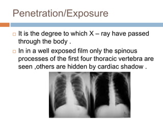 Penetration/Exposure
 It is the degree to which X – ray have passed
through the body .
 In in a well exposed film only the spinous
processes of the first four thoracic vertebra are
seen ,others are hidden by cardiac shadow .
 