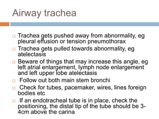 Airway trachea
 Trachea gets pushed away from abnormality, eg
pleural effusion or tension pneumothorax
 Trachea gets pulled towards abnormality, eg
atelectasis
 Beware of things that may increase this angle, eg
left atrial enlargement, lymph node enlargement
and left upper lobe atelectasis
 Follow out both main stem bronchi
 Check for tubes, pacemaker, wires, lines foreign
bodies etc
 If an endotracheal tube is in place, check the
positioning, the distal tip of the tube should be 3-
4cm above the carina
 