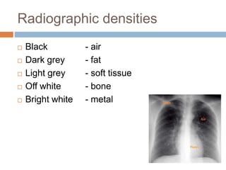 Radiographic densities
 Black - air
 Dark grey - fat
 Light grey - soft tissue
 Off white - bone
 Bright white - metal
 