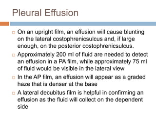 Pleural Effusion
 On an upright film, an effusion will cause blunting
on the lateral costophrenicsulcus and, if large
enough, on the posterior costophrenicsulcus.
 Approximately 200 ml of fluid are needed to detect
an effusion in a PA film, while approximately 75 ml
of fluid would be visible in the lateral view
 In the AP film, an effusion will appear as a graded
haze that is denser at the base
 A lateral decubitus film is helpful in confirming an
effusion as the fluid will collect on the dependent
side
 