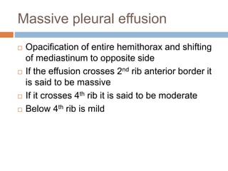 Massive pleural effusion
 Opacification of entire hemithorax and shifting
of mediastinum to opposite side
 If the effusion crosses 2nd rib anterior border it
is said to be massive
 If it crosses 4th rib it is said to be moderate
 Below 4th rib is mild
 