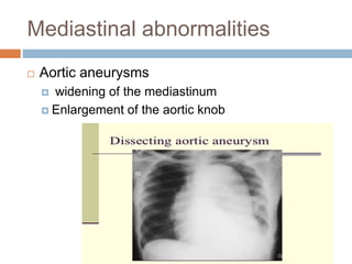 Mediastinal abnormalities
 Aortic aneurysms
 widening of the mediastinum
 Enlargement of the aortic knob
 