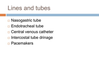 Lines and tubes
 Nasogastric tube
 Endotracheal tube
 Central venous catheter
 Intercostal tube drinage
 Pacemakers
 