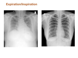 Xray basics by me | PPTX