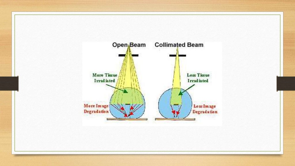 Xray beam restrictors 1436711280968