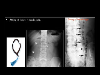 Xray cases radiology residents-must know | PDF