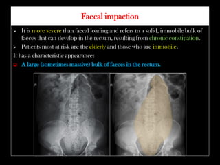 Xray cases radiology residents-must know | PDF