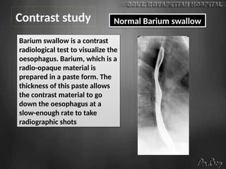 Contrast study Normal Barium swallow
Barium swallow is a contrast
radiological test to visualize the
oesophagus. Barium, which is a
radio-opaque material is
prepared in a paste form. The
thickness of this paste allows
the contrast material to go
down the oesophagus at a
slow-enough rate to take
radiographic shots
 