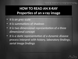 HOW TO READ AN X-RAY
Properties of an x-ray image
• It is an grey scale
• It is summations of shadows
• It is two dimensional representation of a three
dimensional concept
• It is a static representation of a dynamic disease
process interpret with history, laboratory findings,
serial image findings
 