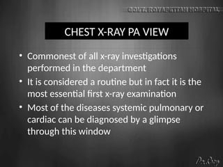 CHEST X-RAY PA VIEW
• Commonest of all x-ray investigations
performed in the department
• It is considered a routine but in fact it is the
most essential first x-ray examination
• Most of the diseases systemic pulmonary or
cardiac can be diagnosed by a glimpse
through this window
 