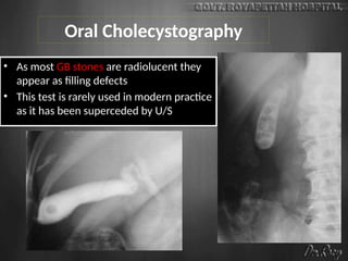 Oral Cholecystography
• As most GB stones are radiolucent they
appear as filling defects
• This test is rarely used in modern practice
as it has been superceded by U/S
 