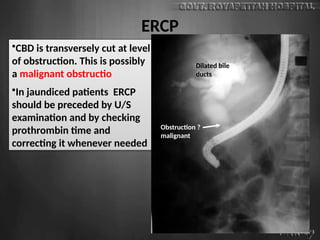 ERCP
•CBD is transversely cut at level
of obstruction. This is possibly
a malignant obstructio
•In jaundiced patients ERCP
should be preceded by U/S
examination and by checking
prothrombin time and
correcting it whenever needed
Dilated bile
ducts
Obstruction ?
malignant
 