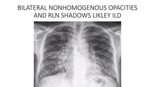 Bilateral Rln X RAY CLASS presentation with full discussion | PPTX