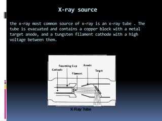 X-ray source
the x-ray most common source of x-ray is an x-ray tube . The
tube is evacuated and contains a copper block with a metal
target anode, and a tungsten filament cathode with a high
voltage between them.
 