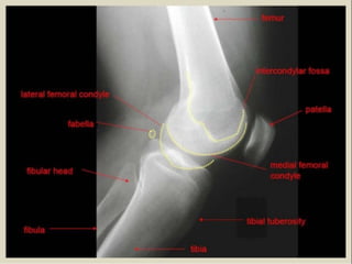 x ray,ct lower limb.pptx lower limb xray | PPTX