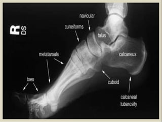 x ray,ct lower limb.pptx lower limb xray | PPTX
