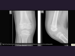 x ray,ct lower limb.pptx lower limb xray | PPTX
