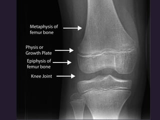 x ray,ct lower limb.pptx lower limb xray | PPTX