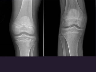 x ray,ct lower limb.pptx lower limb xray | PPTX