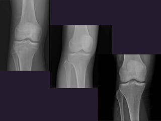 x ray,ct lower limb.pptx lower limb xray | PPTX