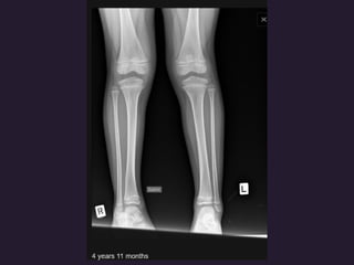 x ray,ct lower limb.pptx lower limb xray | PPTX