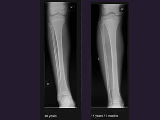 x ray,ct lower limb.pptx lower limb xray | PPTX